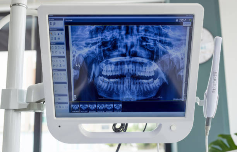 Best Digital xray Facility at Dental clinic Near Me